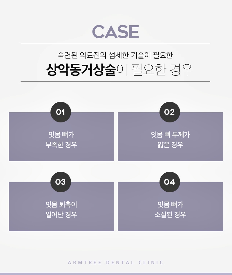 상악동거상술 통증이 걱정된다면 관련 이미지 6