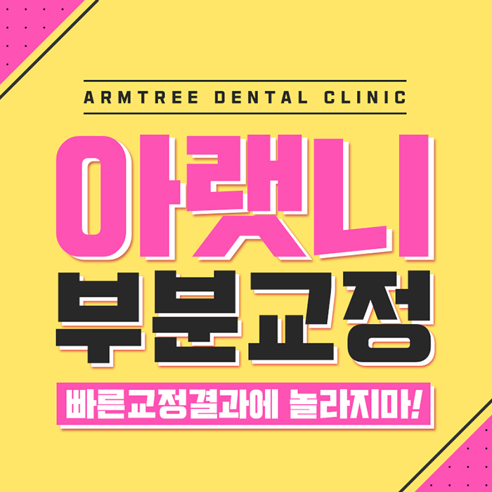 아랫니부분교정 단기치아교정으로 말끔히 관련 이미지 1