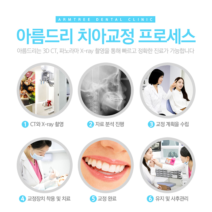 아름드리치과 치아교정 탑클래스 관련 이미지 4