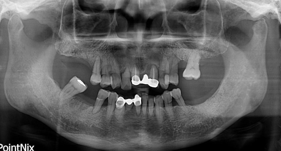 당뇨병과 잇몸병?(당뇨합병증 이겨내기) 관련 이미지 6