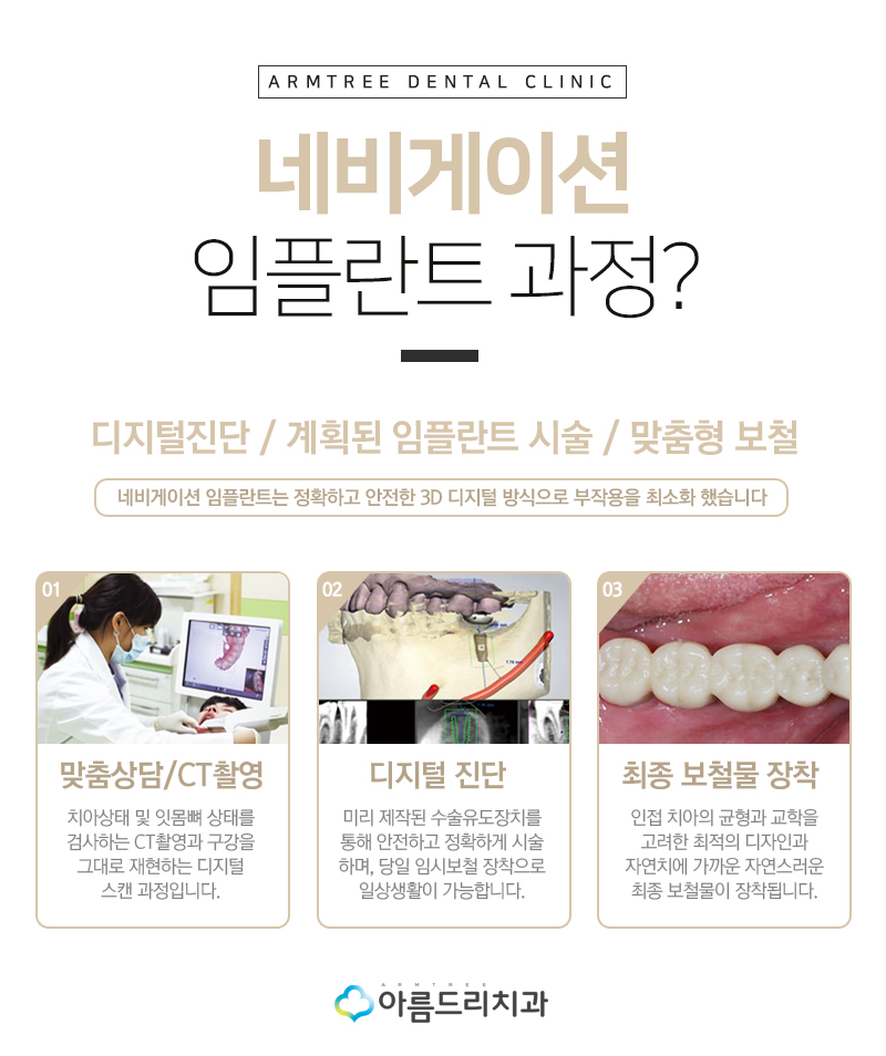 인플란트통증 디지털임플란트 좋은이유 관련 이미지 5