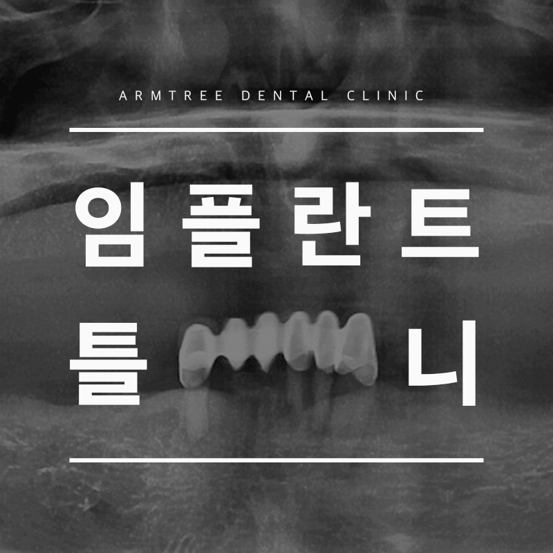 임플란트틀니 정직한 신논현역 아름드리치과 관련 이미지 1