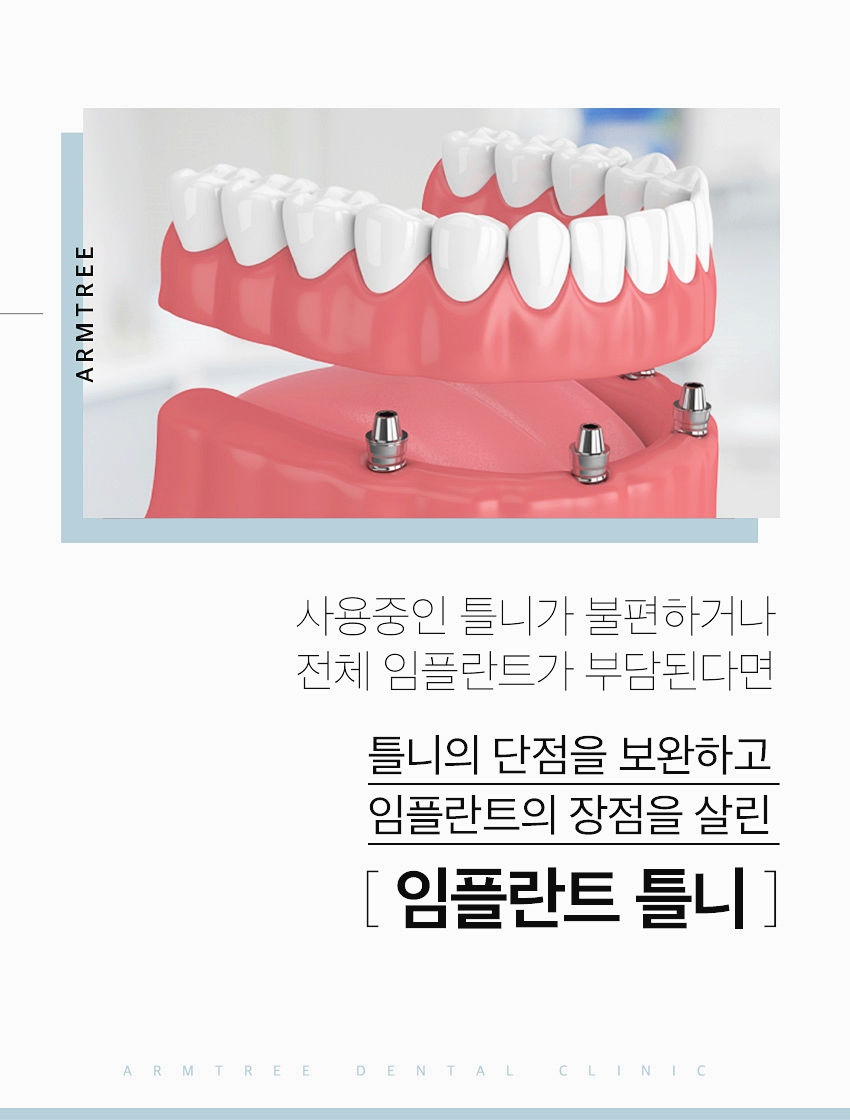 임플란트틀니 아름드리치과에 만족하면서 관련 이미지 2