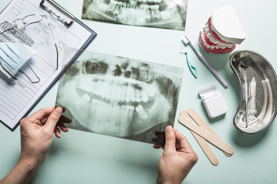 [신논현 치과] 몸의 영양상태가 치아에 미치는 영향(아름드리치과) 관련 이미지 1