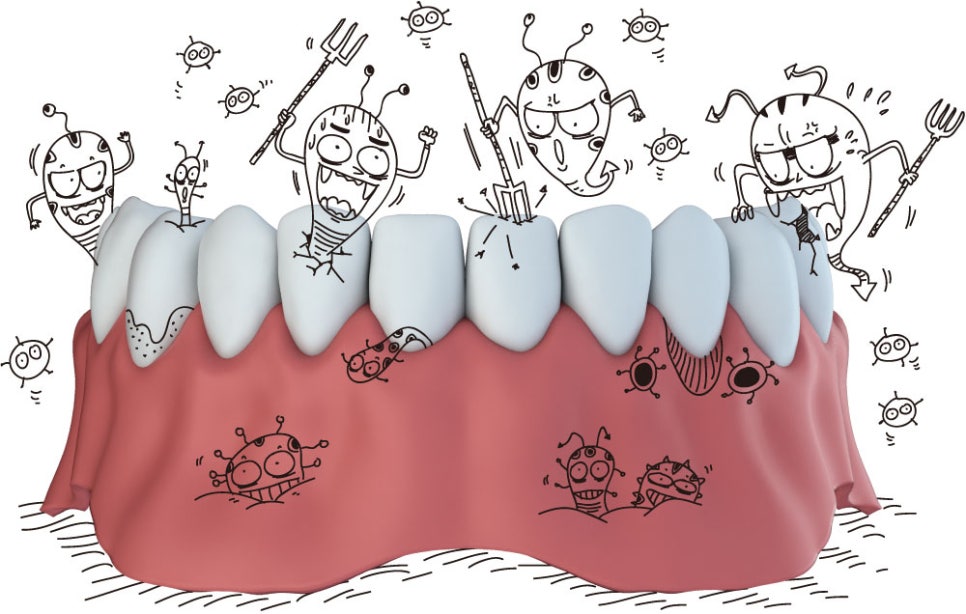[신논현 치과] 안 시리고, 안 아픈 스케일링_아름드리 치과 관련 이미지 1