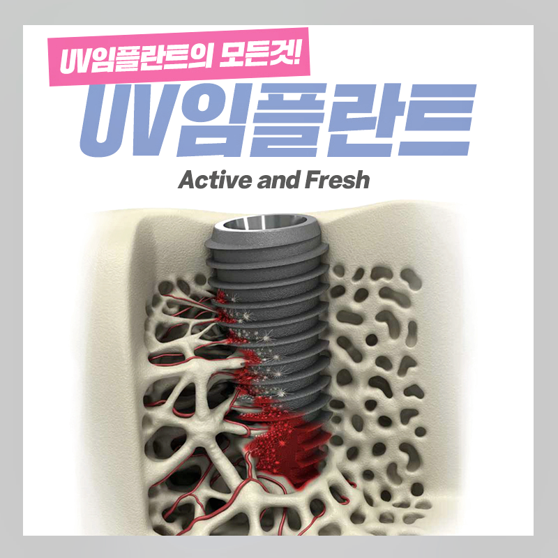 UV임플란트 부작용 걱정없이 아름드리치과 관련 이미지 1