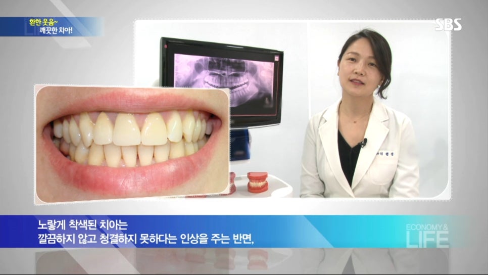 SBS 생활경제-이현정원장님 치아미백 인터뷰 관련 이미지 4