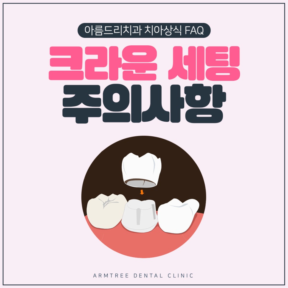 치과 크라운치료 세팅 주의사항 관련 이미지 1