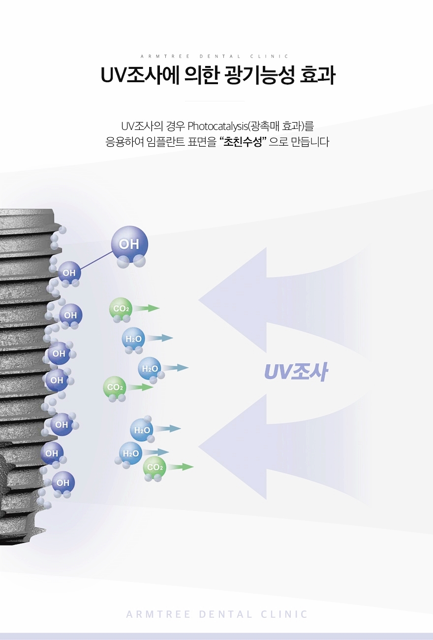 신논현역 UV임플란트 아름드리치과라면 관련 이미지 5