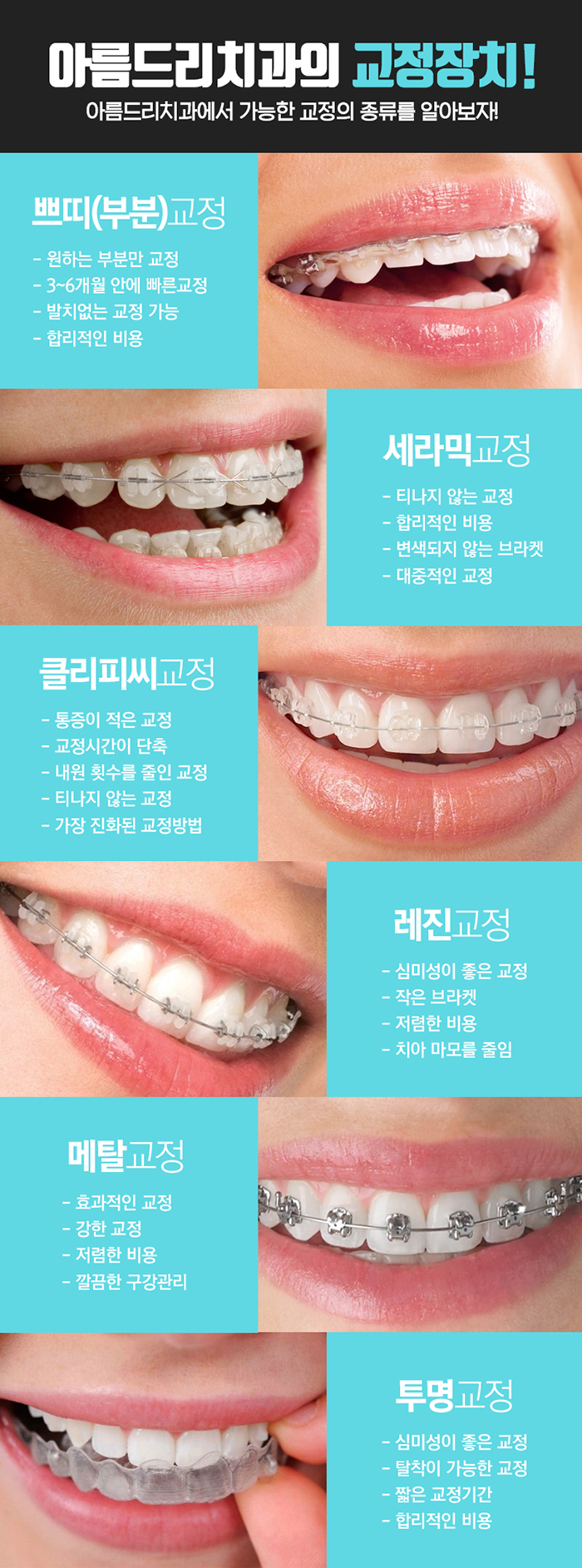 신논현치과 교정의 모든것 아름드리 관련 이미지 3