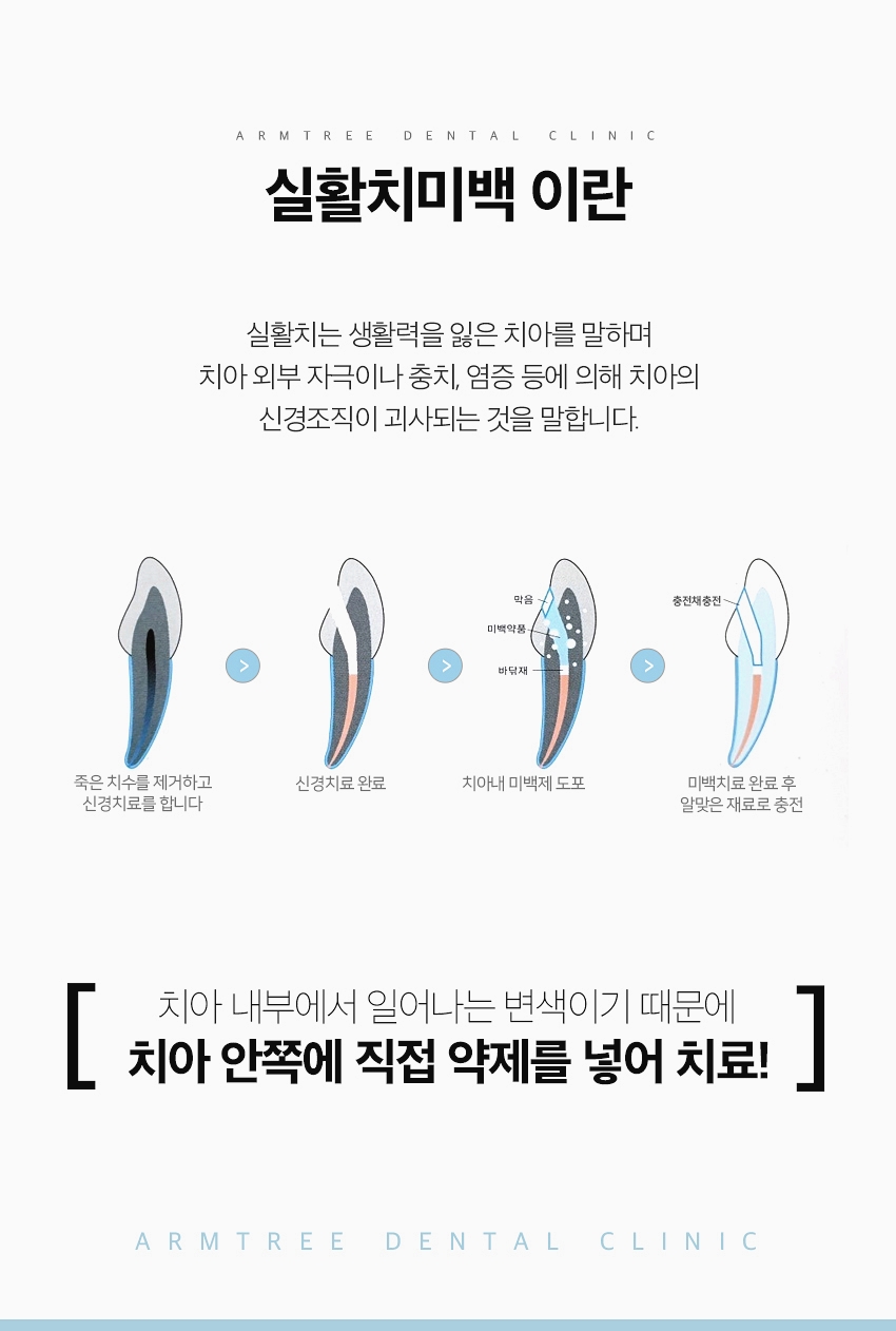 실활치미백 앞니변색 걱정없는 아름드리치과 관련 이미지 3