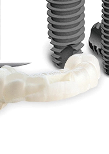 디지털임플란트 당일임플란트로 정확하고 안전하다면 관련 이미지 14