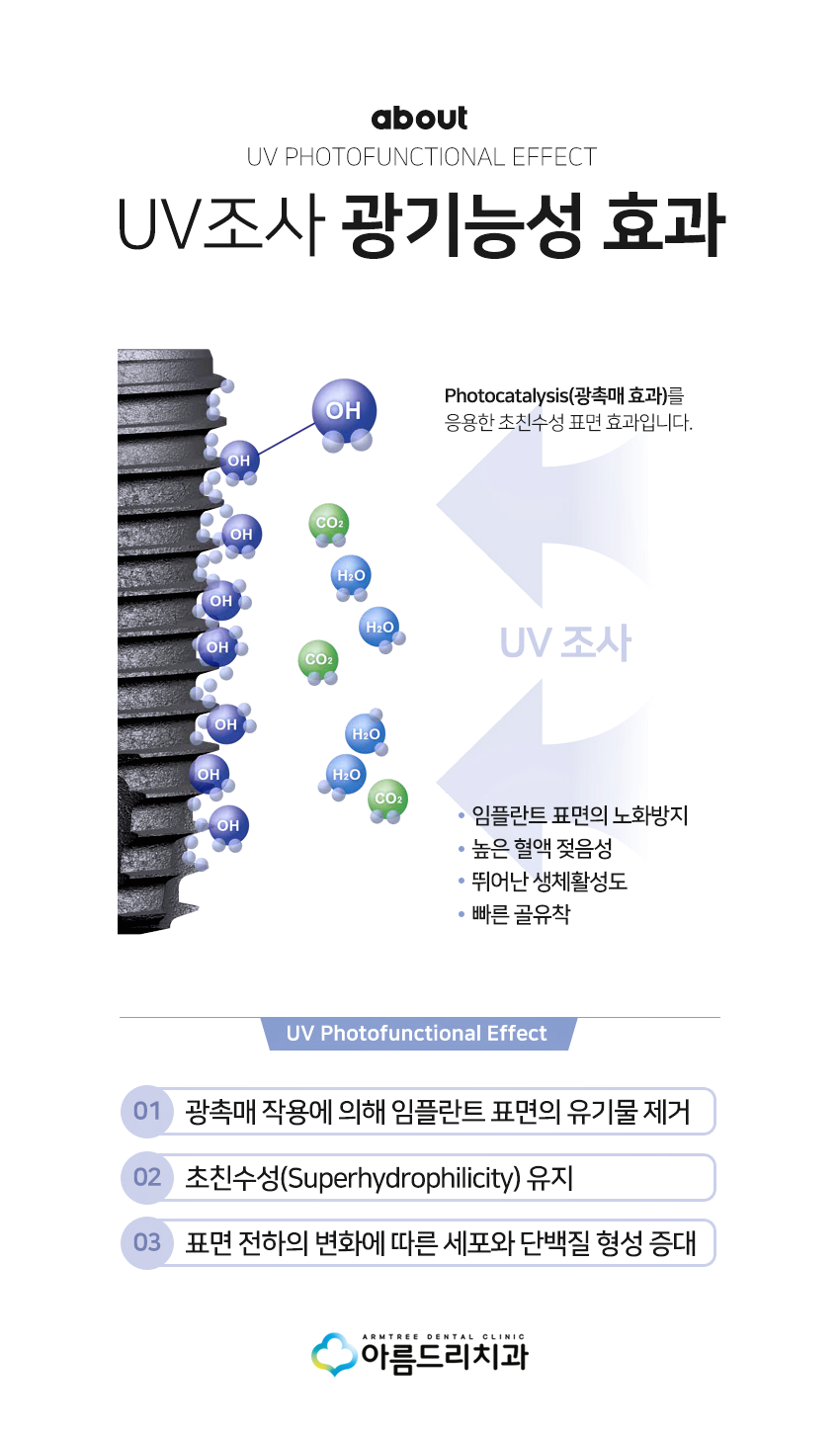 UV임플란트 부작용 걱정없이 아름드리치과 관련 이미지 4