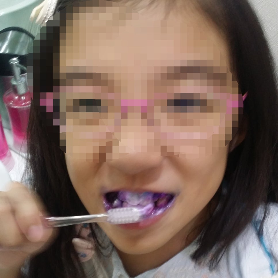 [신논현치과]어린이양치교육_구강검진_유아충치_충치예방 관련 이미지 7