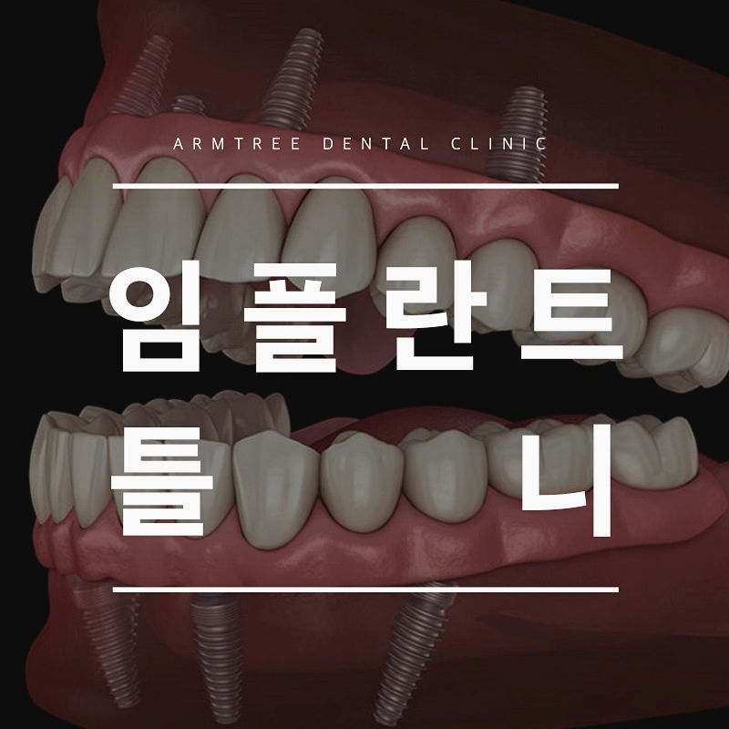 임플란트틀니 신논현역 아름드리치과 관련 이미지 1