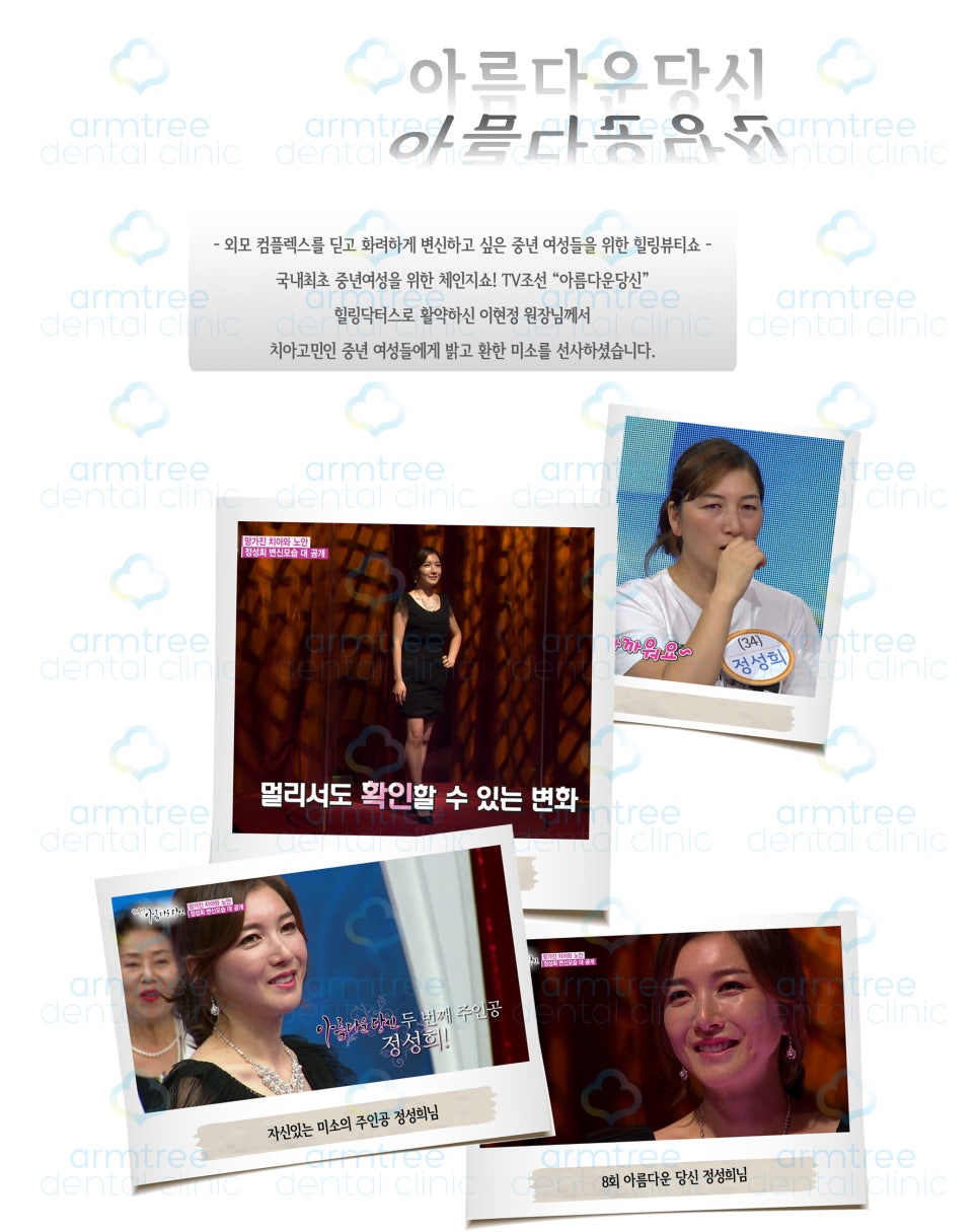 이현정 원장의 아름다운 당신 시즌 1 (8회 정성희 도전자) 임플란트, 신경치료, 치아성형, 올세라믹, 치아미백, 화이트랩스 관련 이미지 1