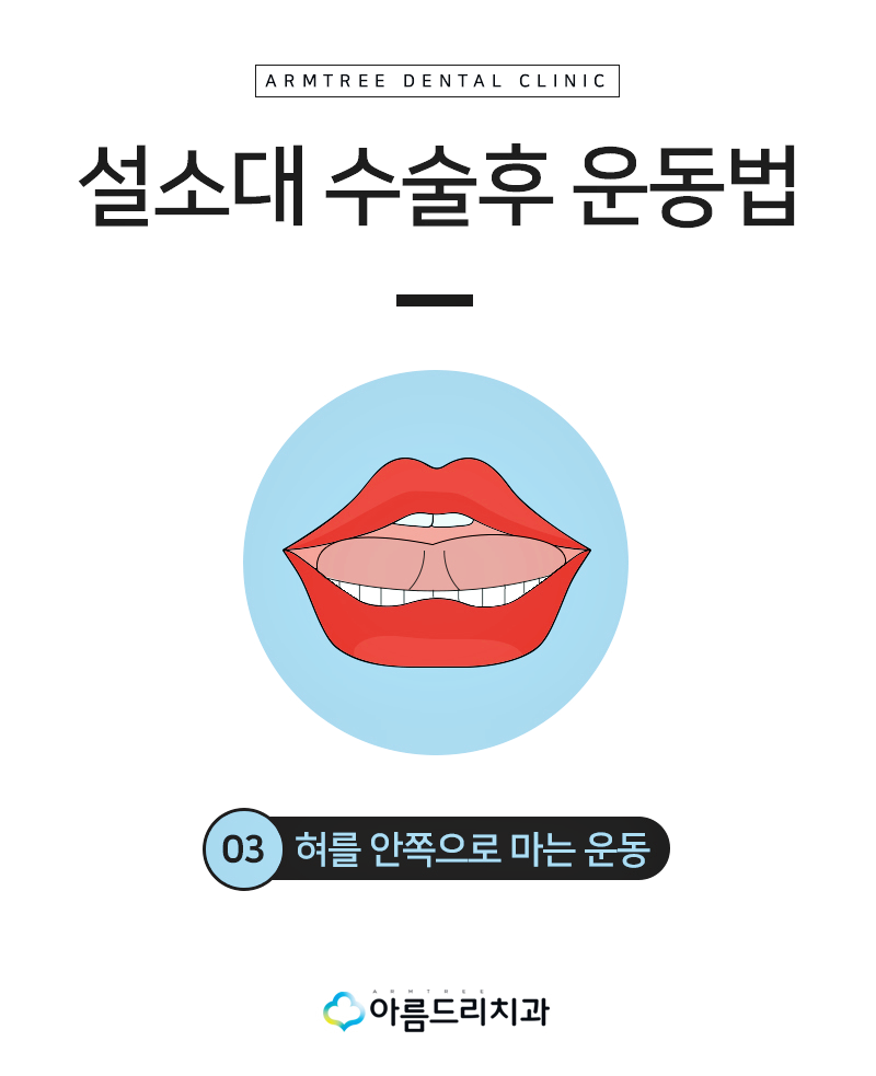 설소대단축증 - 단설소대증의 치료과정 관련 이미지 12