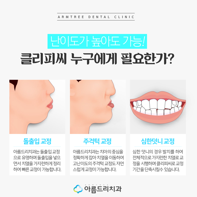 클리피시교정 후기와 기간 궁금해? 관련 이미지 6