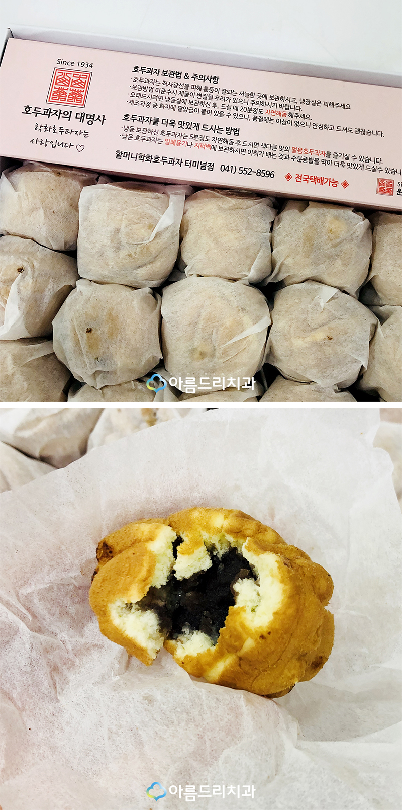 인비절라인교정 투명치아교정 후기 관련 이미지 3