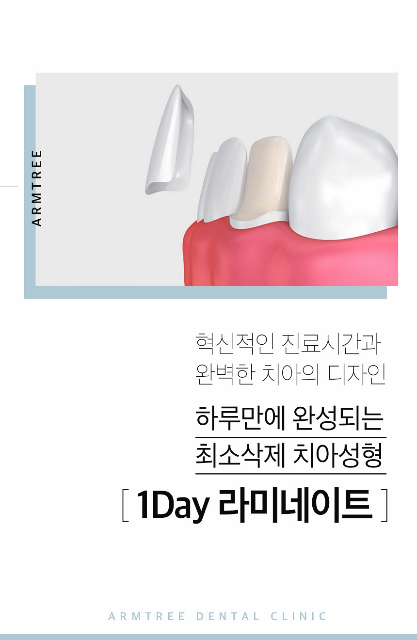 앞니라미네이트 부작용없는선택 아름드리치과 관련 이미지 2