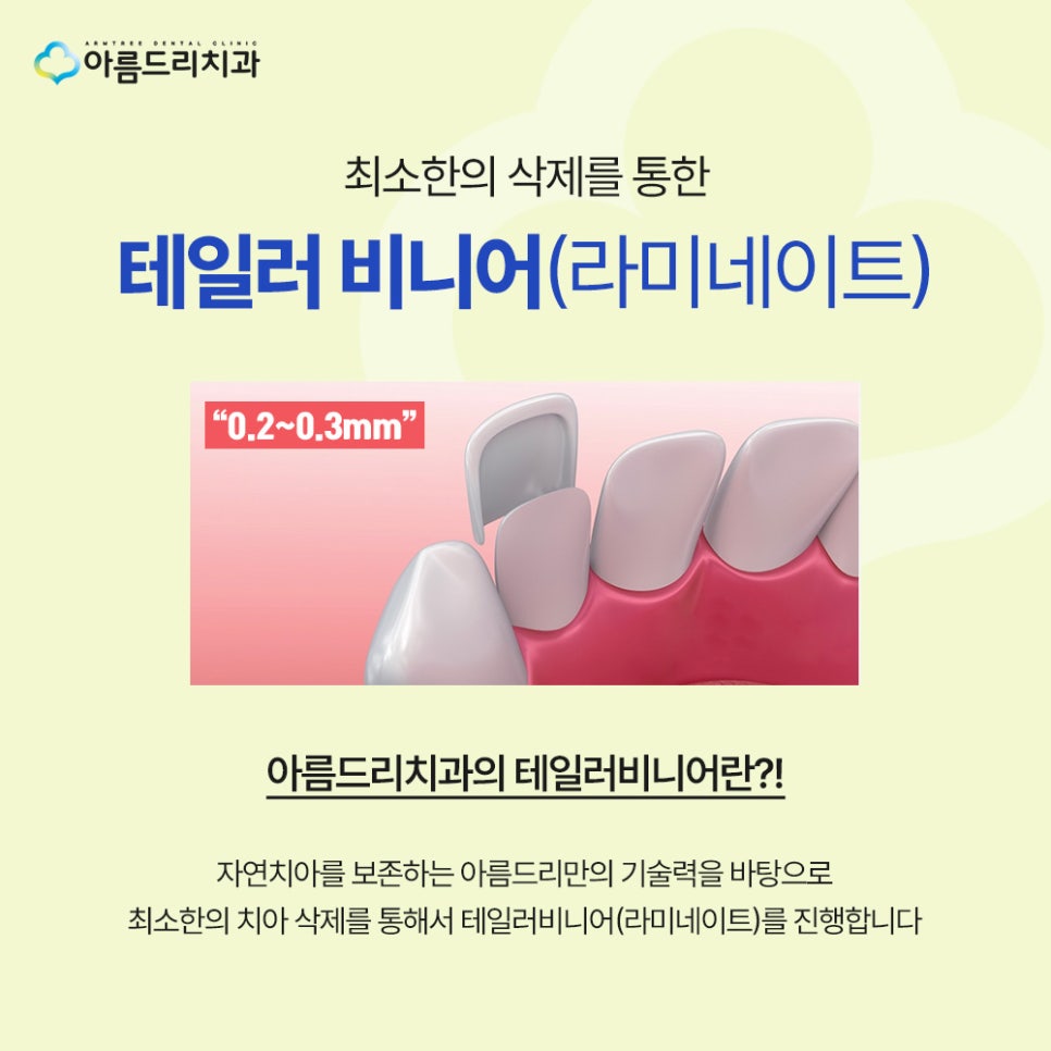 강남 라미네이트 부작용, 시림 현상, 깨짐, 탈락, 예방하는 방법 관련 이미지 7