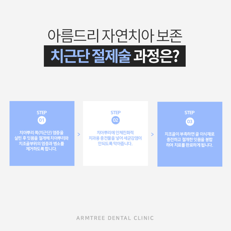 치근단절제술 후기로보는 완벽함 관련 이미지 6