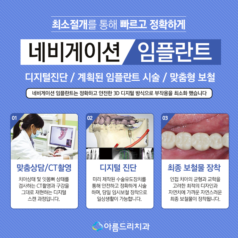 컴퓨터분석임플란트 잘하는 아름드리치과 관련 이미지 4