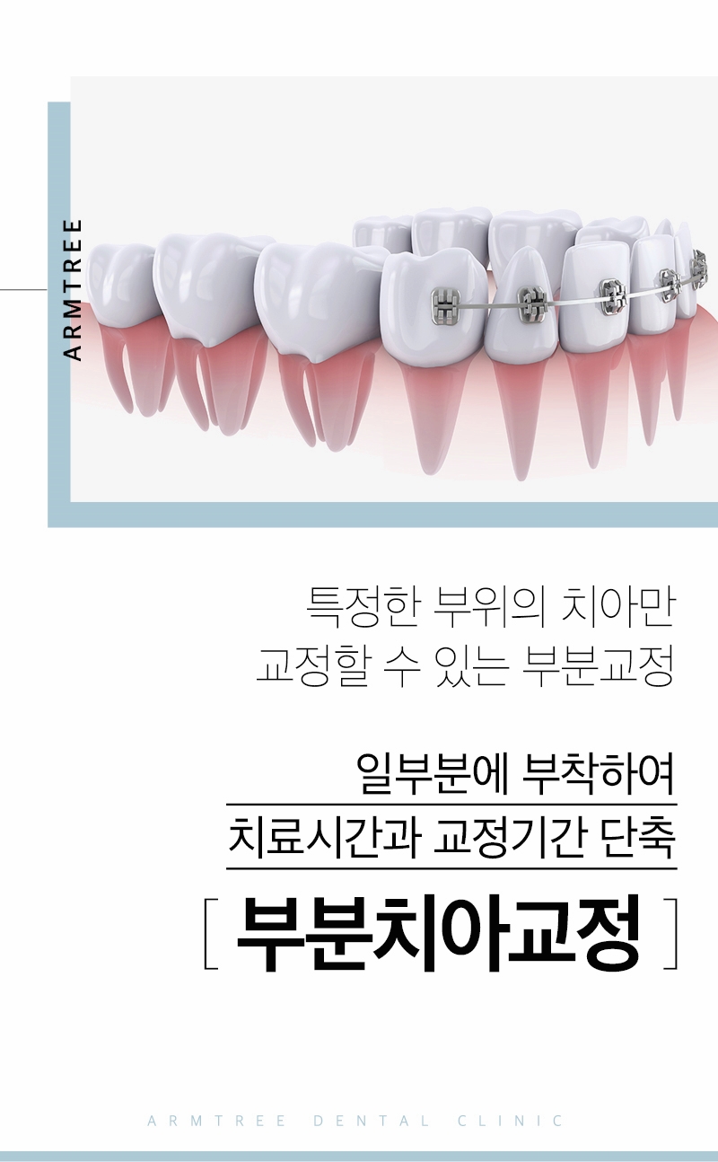 벌어진앞니교정 아름드리치과에서 고민해결 관련 이미지 2