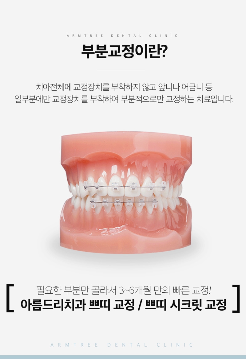 벌어진앞니부분교정 후기 신논현역 아름드리치과는 관련 이미지 3