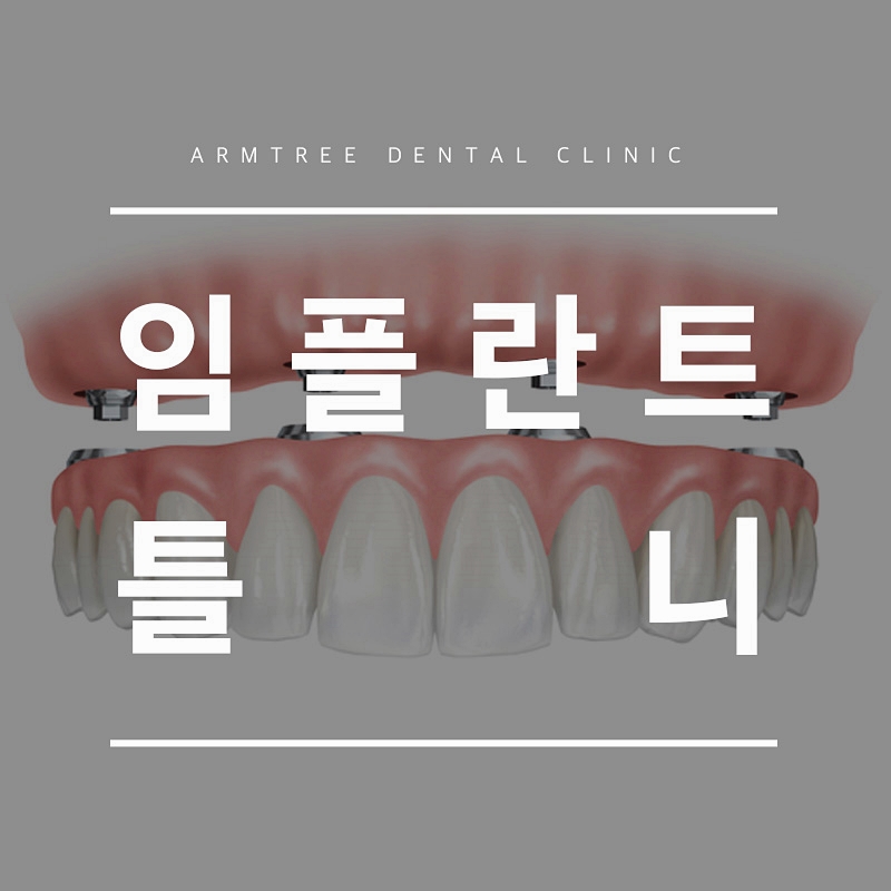 임플란트틀니 아름드리치과에 만족하면서 관련 이미지 1