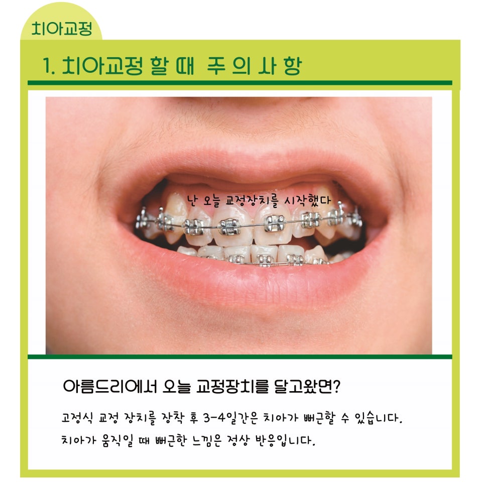 신논현역치과_치아교정시 지켜야 할 주의사항_아름드리치과 관련 이미지 3