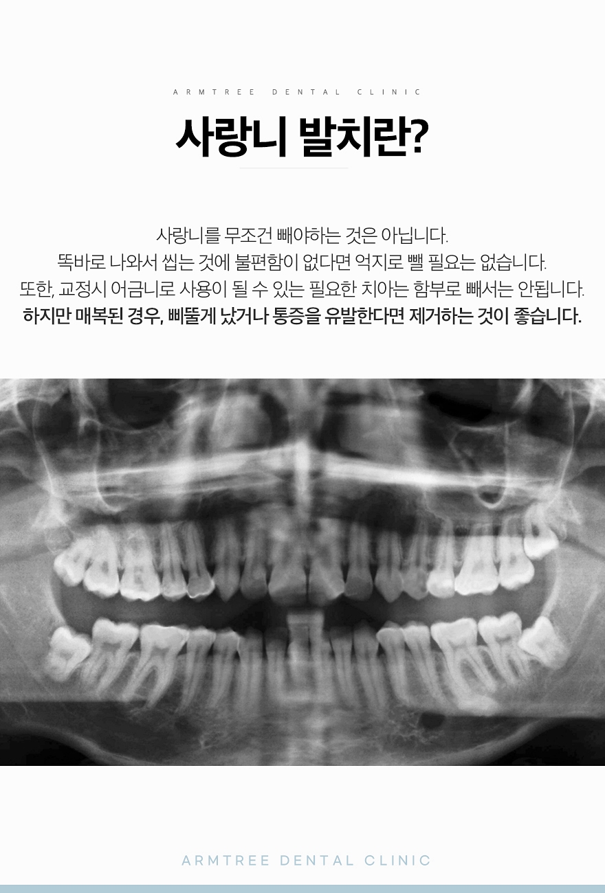 신논현 사랑니발치 선택하려면 관련 이미지 3