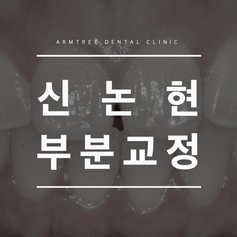 신논현역 야간진료치과 부분교정은 아름드리치과 관련 이미지 1