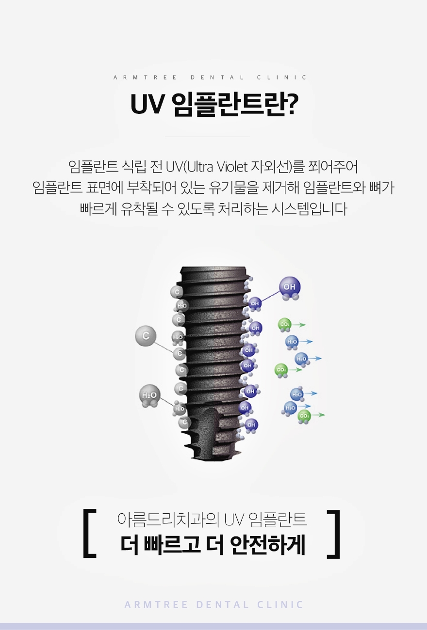 신논현 앞니임플란트 심미성이 중요하다면 관련 이미지 3