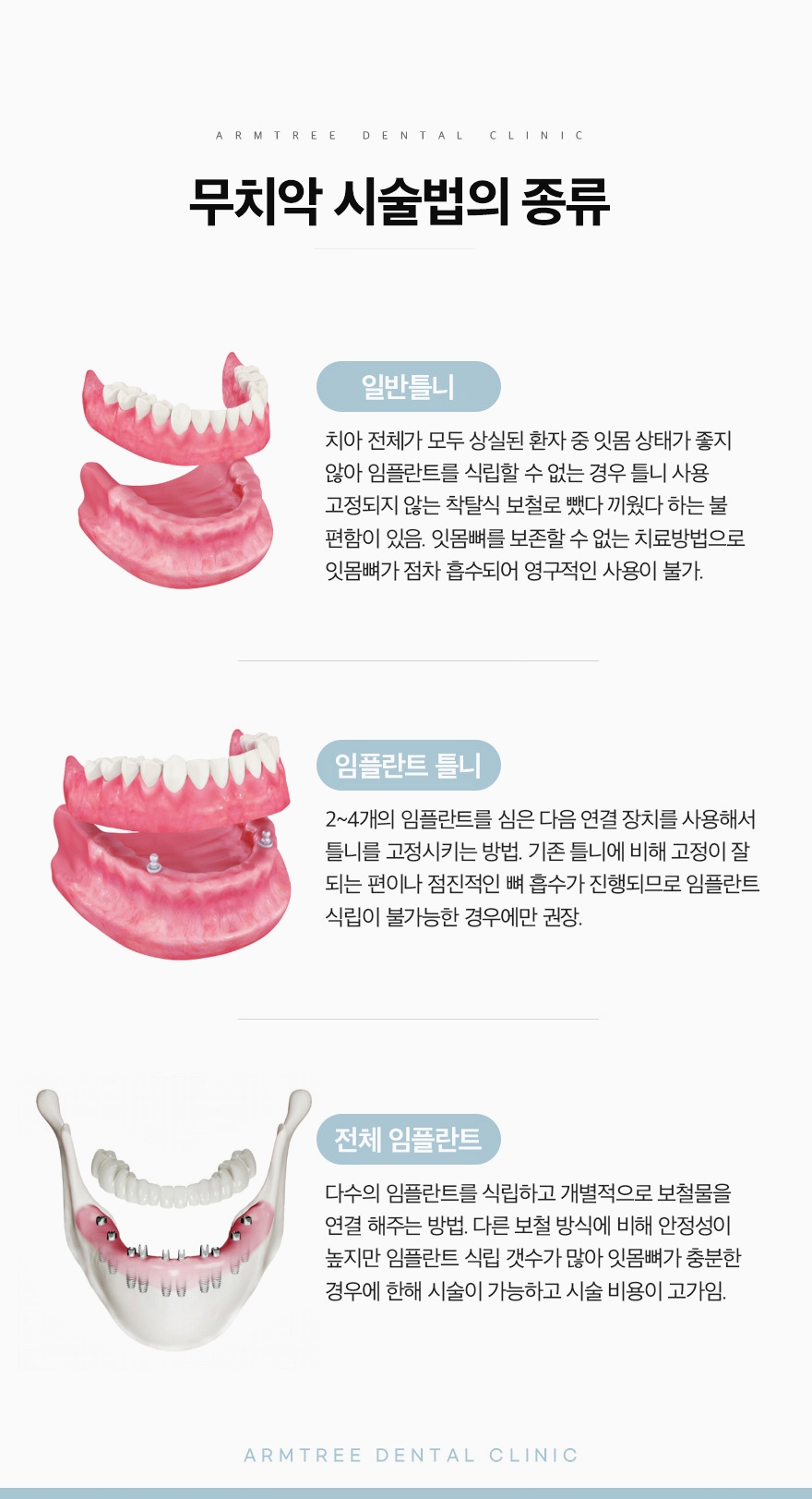 신논현역 전체임플란트는 풀아치임플란트로 관련 이미지 4