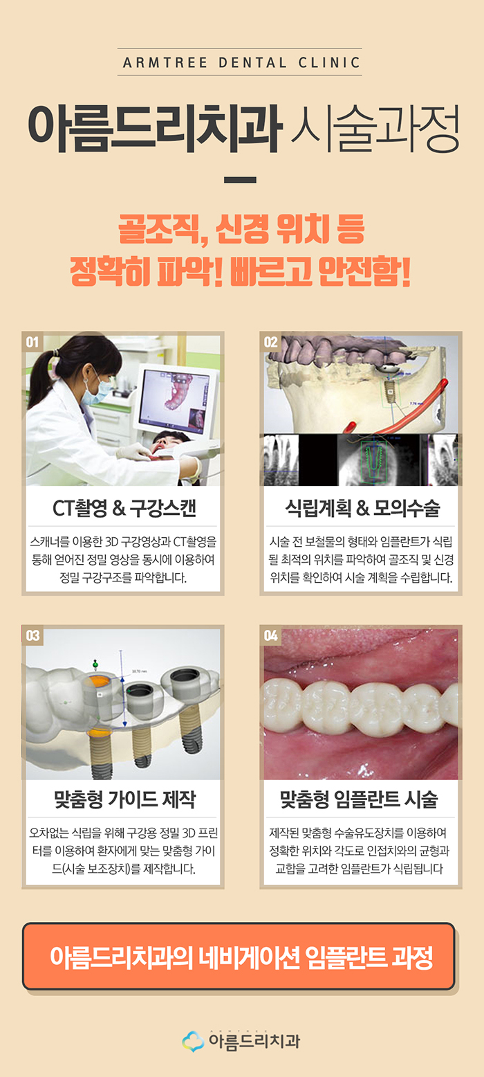 컴퓨터분석 임플란트 비용 아름드리 관련 이미지 5