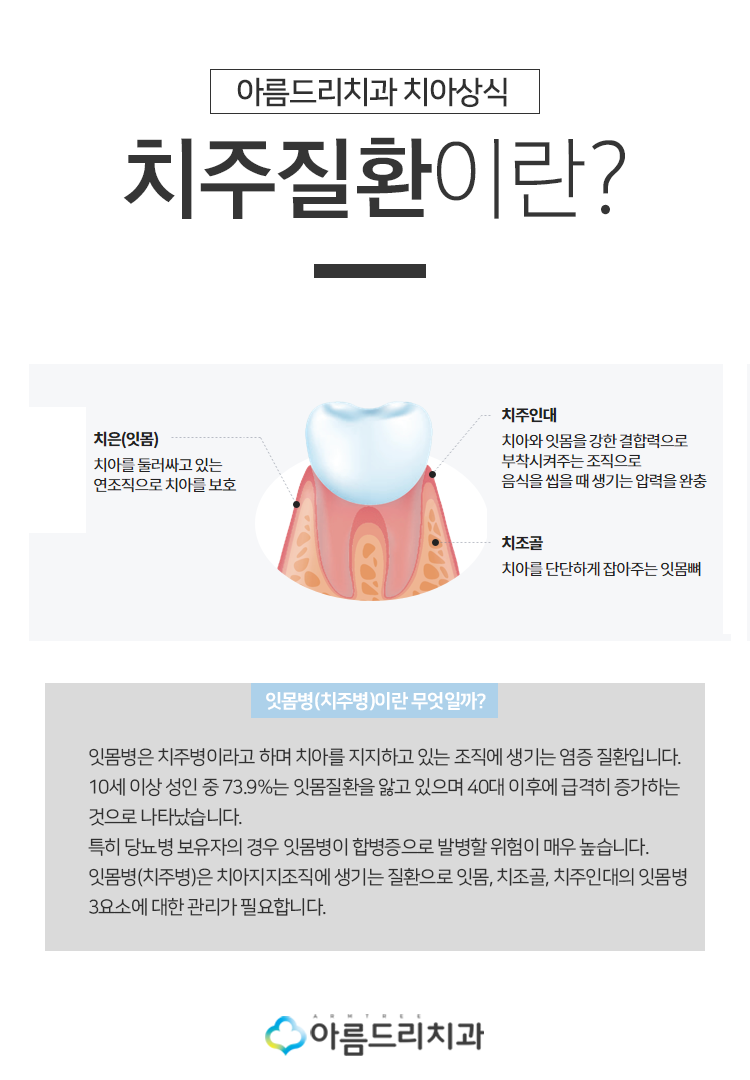 인사돌 이가탄 효과와 잇몸약, 치과에서 바라보다! 관련 이미지 3