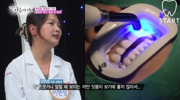 이현정 원장의 아름다운 당신 시즌 1 (9회 홍승희 도전자) 잇몸미백, 치아미백 관련 이미지 5