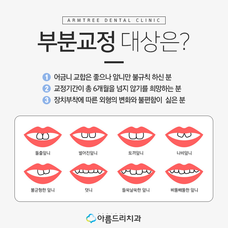 토끼이빨교정 앞니문제 해결 관련 이미지 5