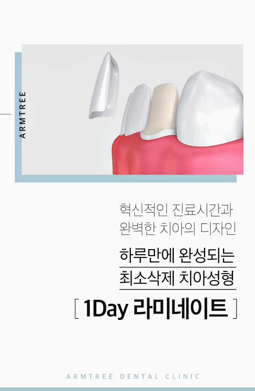 신논현라미네이트 고민만 하고 있다면 관련 이미지 2