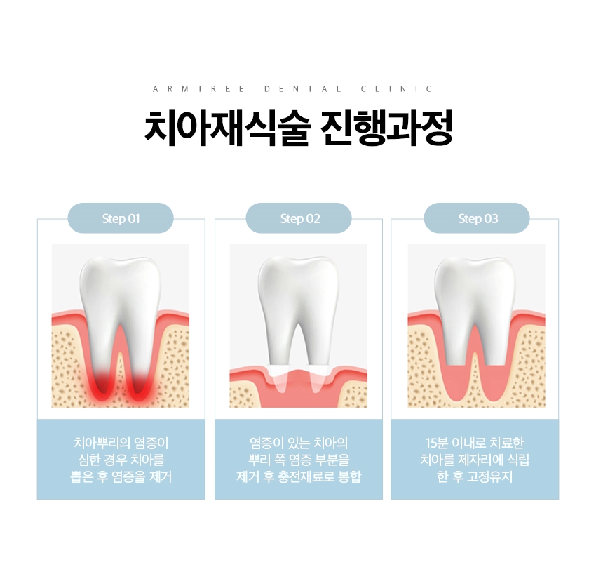 잇몸고름주머니치료 염증제거 아름드리치과 관련 이미지 10