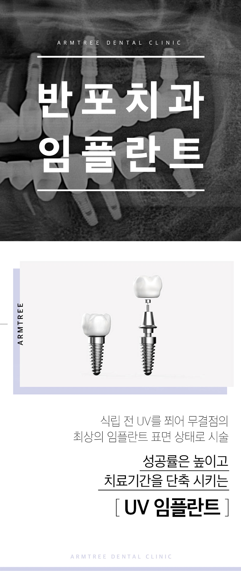 반포치과 임플란트 제대로 하려면 관련 이미지 1