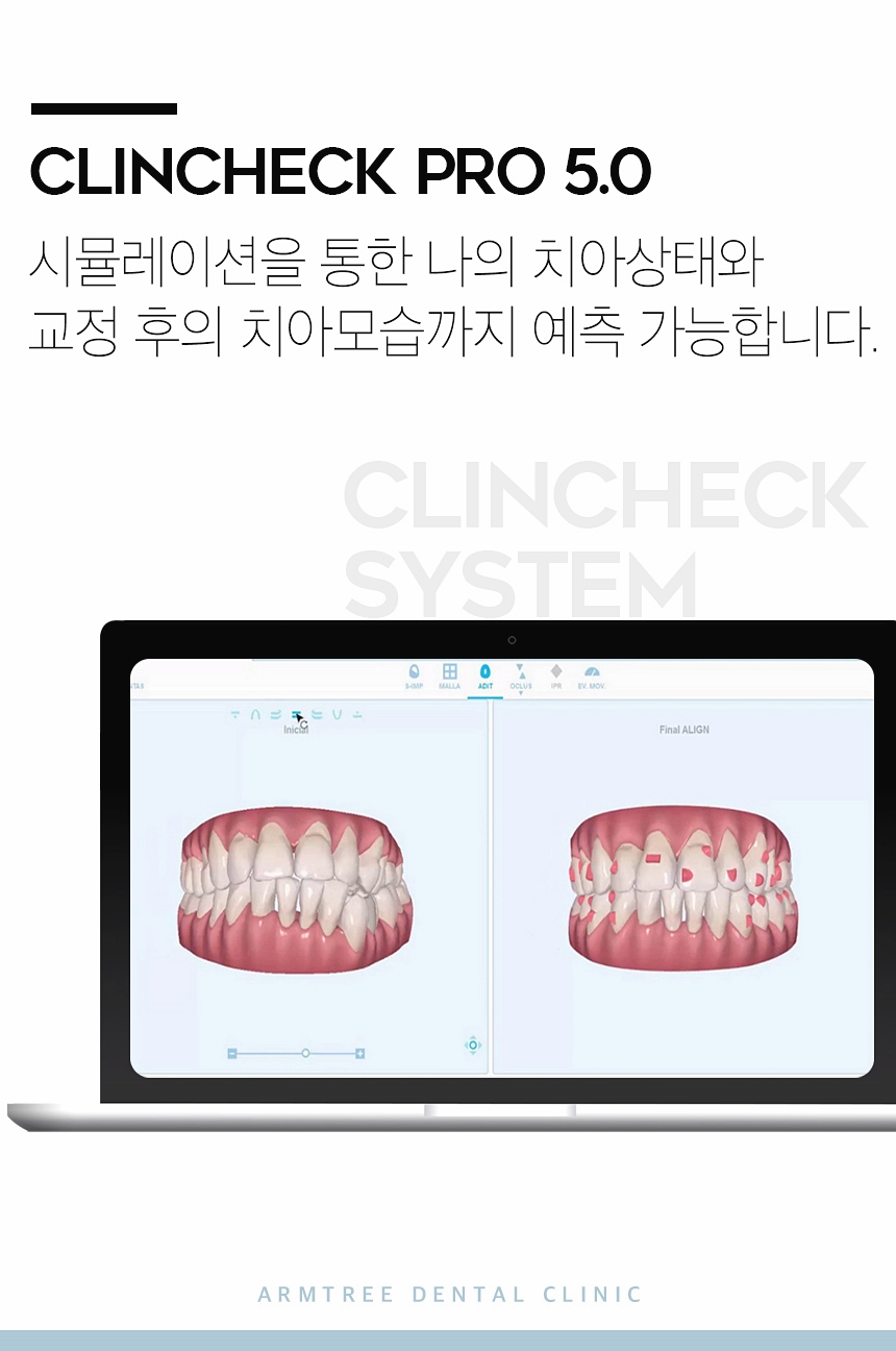 치아교정종류 신뢰가는 신논현역치과 관련 이미지 8
