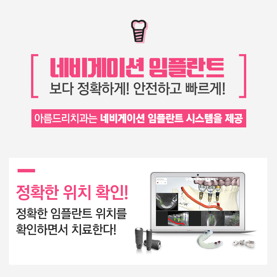 강남임플란트 아름드리 들어봤니? 관련 이미지 2