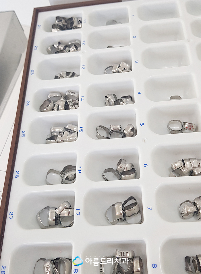 어린이치아교정 부정교합 RPE(급속구개확장장치) 악궁확장장치 관련 이미지 6