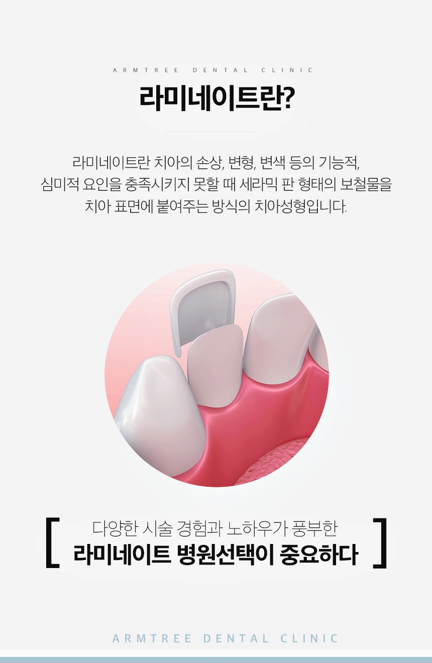 신논현라미네이트 고민만 하고 있다면 관련 이미지 3