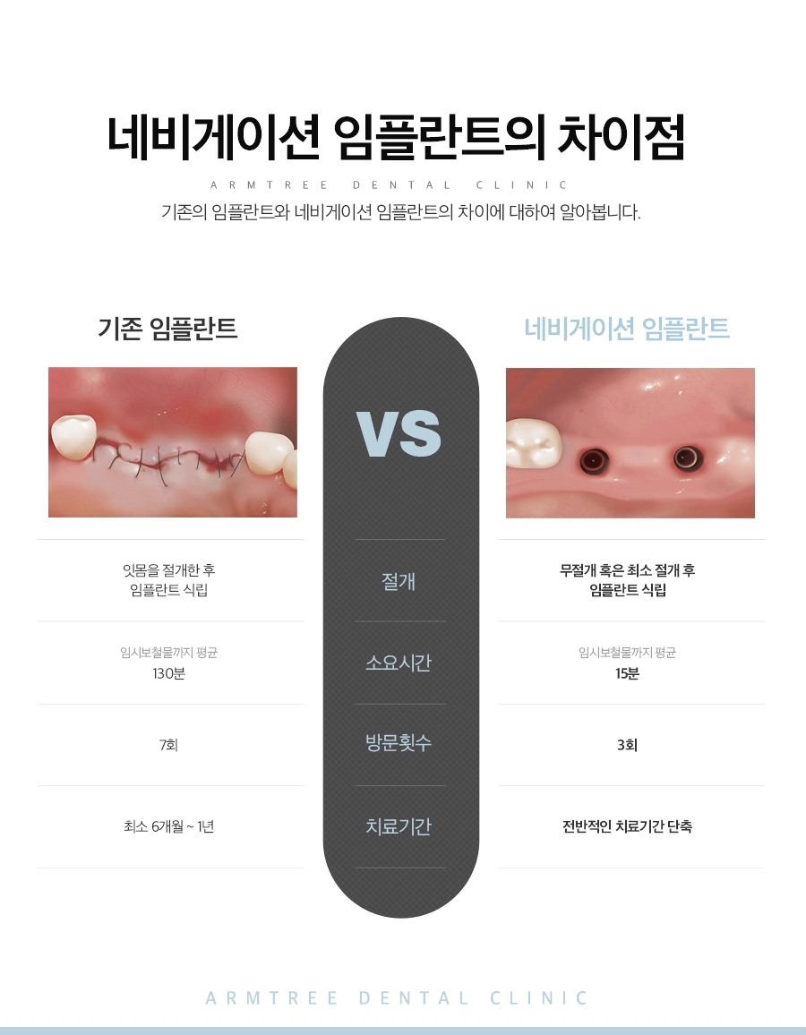 임플란트종류 오래쓰는 선택은 관련 이미지 4
