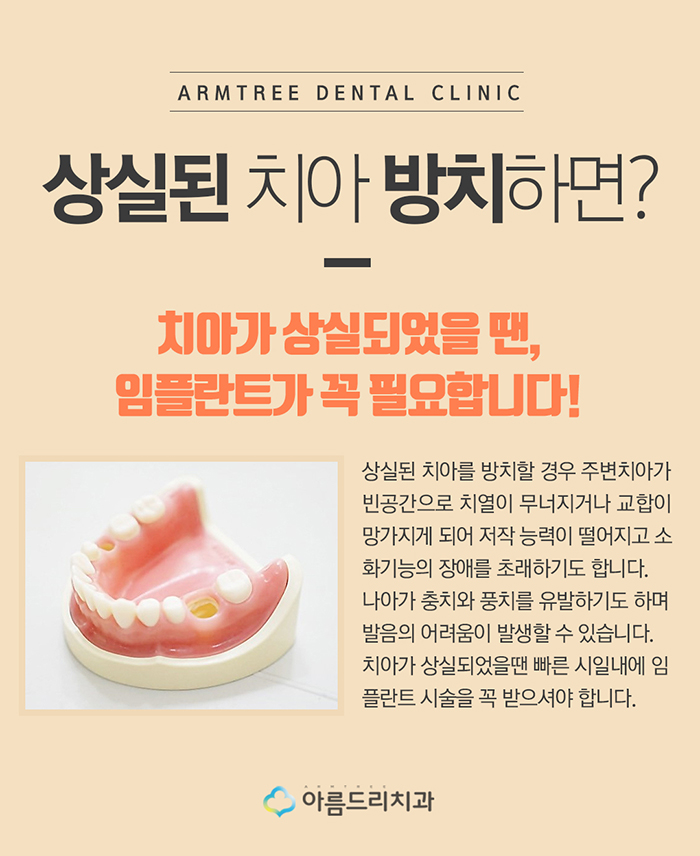 컴퓨터분석 임플란트 비용 아름드리 관련 이미지 3
