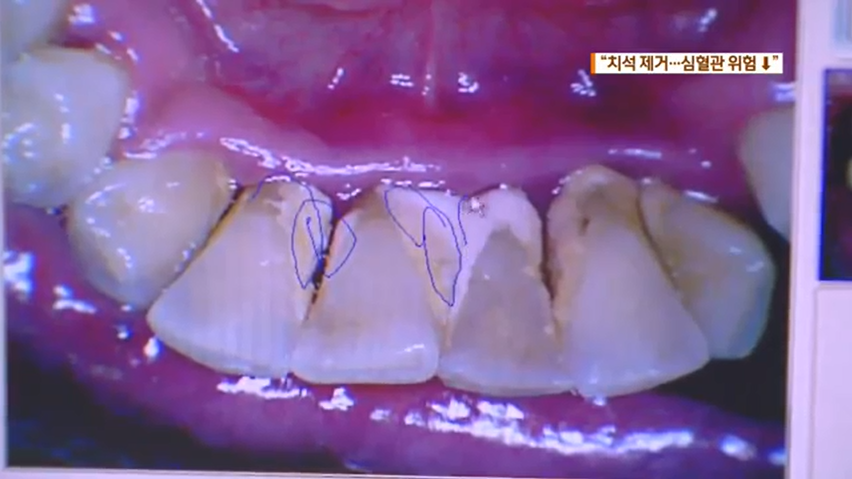 보험 스케일링 6월 마지막 기회 관련 이미지 5