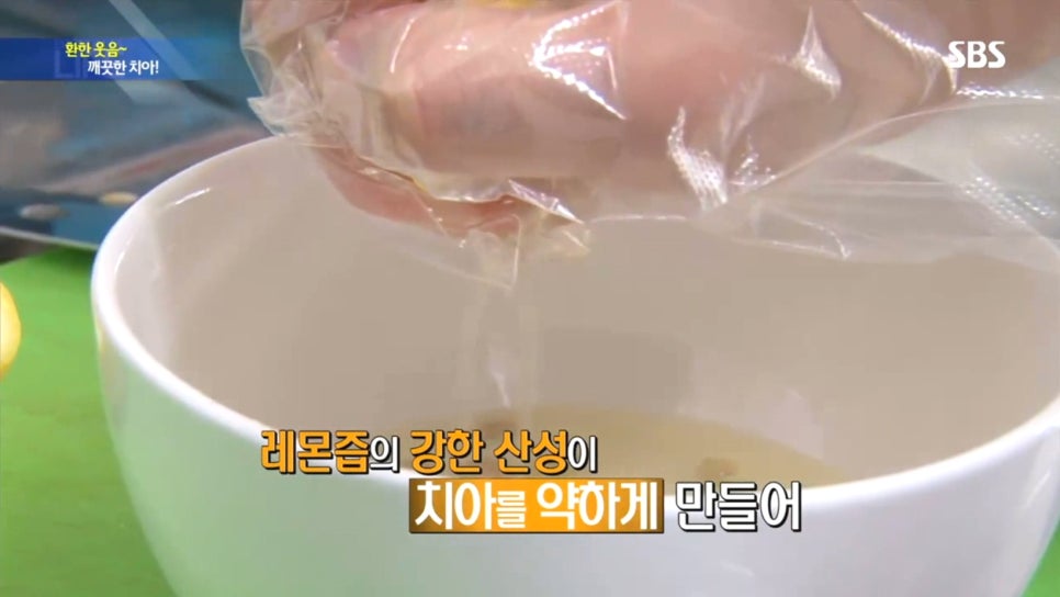 SBS 생활경제-이현정원장님 치아미백 인터뷰 관련 이미지 7